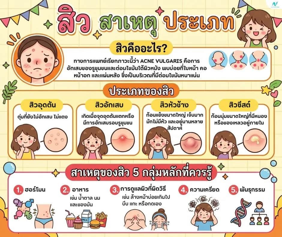 บทความสุขภาพ: สิว: สาเหตุ ประเภท และวิธีรักษาที่ได้ผล