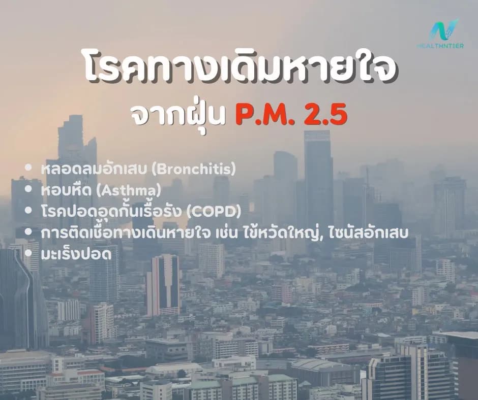 ภาพประกอบ: โรคทางเดินหายใจจากฝุ่น pm2.5 ป้องกันก่อนป่วยเรื้อรัง