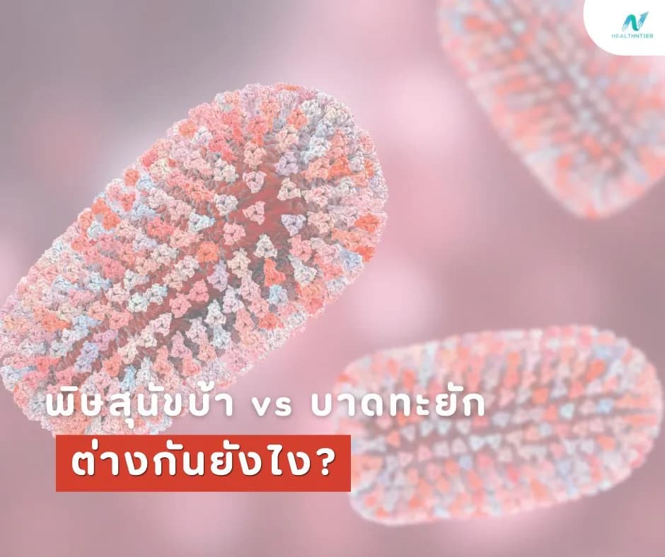 ภาพประกอบ: พิษสุนัขบ้า vs บาดทะยัก ต่างกันยังไง? เข้าใจง่าย ไม่ต้องกลัวฉีดผิด