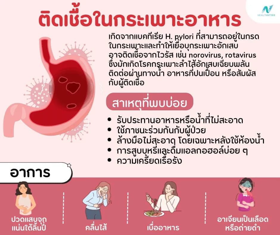 บทความสุขภาพ: ติดเชื้อในกระเพาะอาหาร อาการเป็นอย่างไร? สาเหตุ วิธีรักษา และป้องกันอย่างถูกต้อง