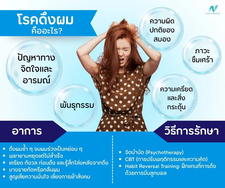 ภาพประกอบด้านสุขภาพจิต: โรคดึงผม (Trichotillomania) คืออะไร? สาเหตุ อาการ และวิธีรักษา