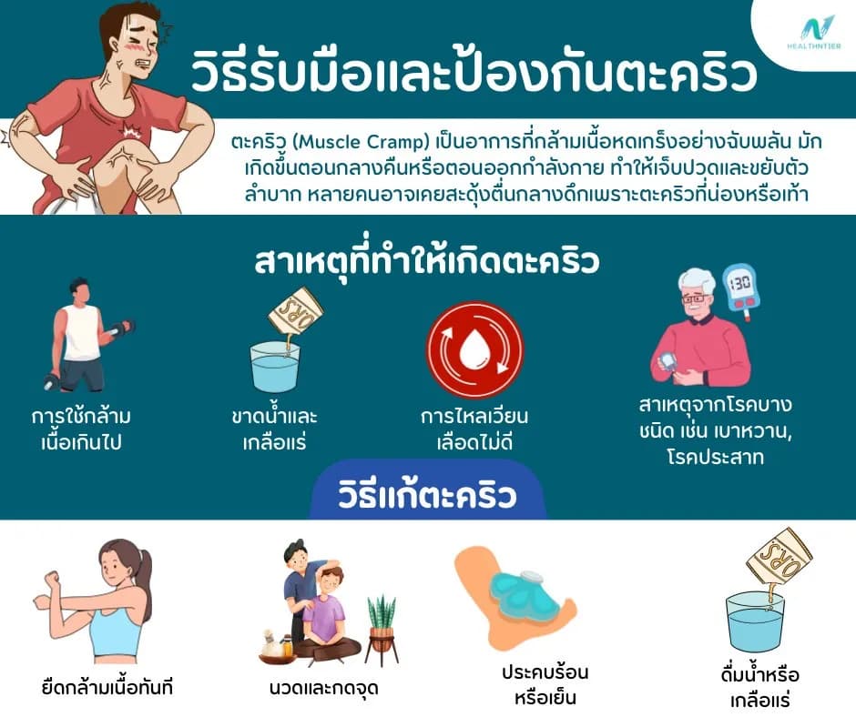 บทความสุขภาพ: เป็นตะคริวแก้ยังไง? วิธีรับมือและป้องกันตะคริวแบบได้ผล