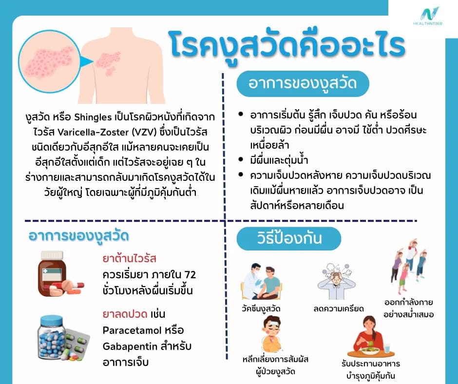 บทความสุขภาพ: งูสวัดคืออะไร? อาการ สาเหตุ วิธีรักษาและป้องกัน พร้อม FAQ