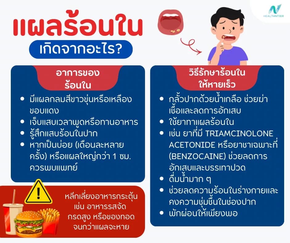 บทความสุขภาพ: ร้อนในเกิดจากอะไร? สาเหตุ อาการ และวิธีรักษาให้หายเร็ว พร้อมเคล็ดลับป้องกัน