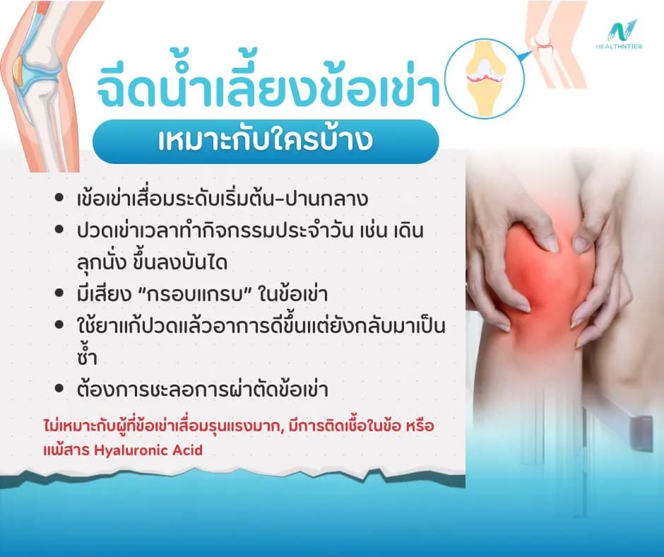 บทความสุขภาพ: ฉีดน้ำเลี้ยงข้อเข่า ราคาเท่าไหร่? เหมาะกับใครบ้าง ปลอดภัยหรือไม่