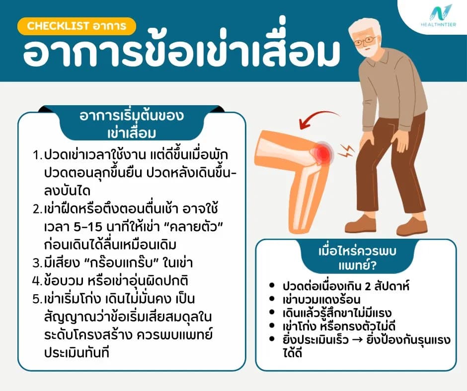 บทความสุขภาพ: เข่าเสื่อมอาการเริ่มต้น เช็กสัญญาณเตือนก่อนอาการหนัก พร้อมวิธีดูแลตัวเอง