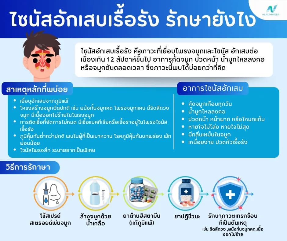 บทความสุขภาพ: ไซนัสอักเสบเรื้อรัง รักษายังไง? วิธีรักษาที่ได้ผลจริง อัพเดตครบสำหรับผู้เป็นเรื้อรัง