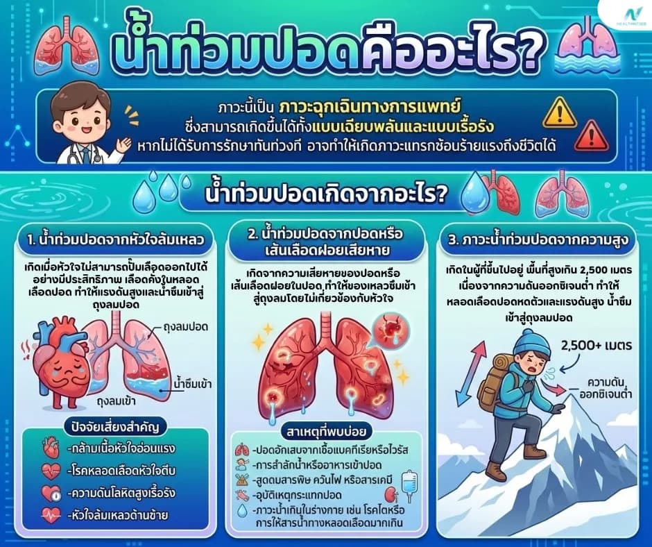 ภาพประกอบด้านสุขภาพ: น้ำท่วมปอด คืออะไร? สาเหตุ อาการ และกลุ่มเสี่ยงที่ต้องรู้