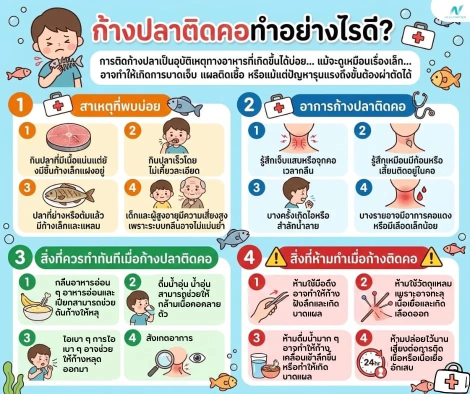 ภาพประกอบด้านสุขภาพ: ก้างปลาติดคอ วิธีแก้ที่ถูกต้องและปลอดภัย