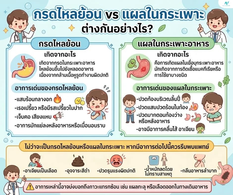 ภาพประกอบ: กรดไหลย้อน vs แผลในกระเพาะอาหาร ต่างกันอย่างไร?
