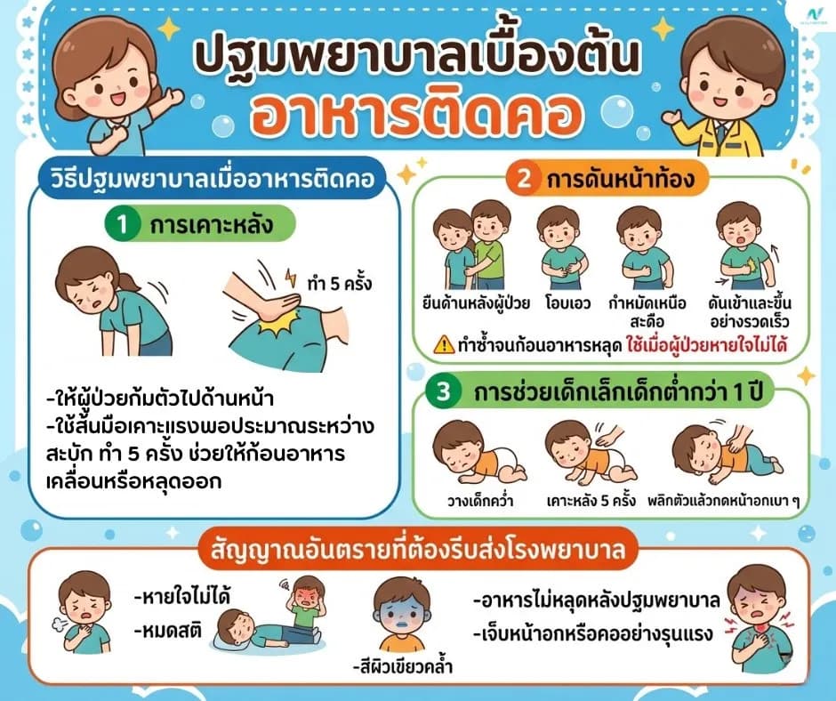 ภาพประกอบ: อาหารติดคอ ปฐมพยาบาลเบื้องต้น ทำอะไรได้ทันทีเมื่อสำลัก