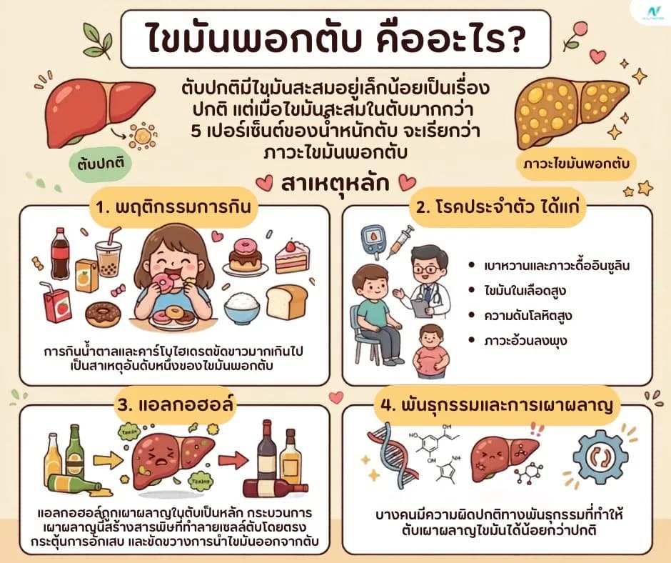 ภาพประกอบ: ไขมันพอกตับ คืออะไร? สาเหตุ อาการ และวิธีรักษาที่ได้ผล