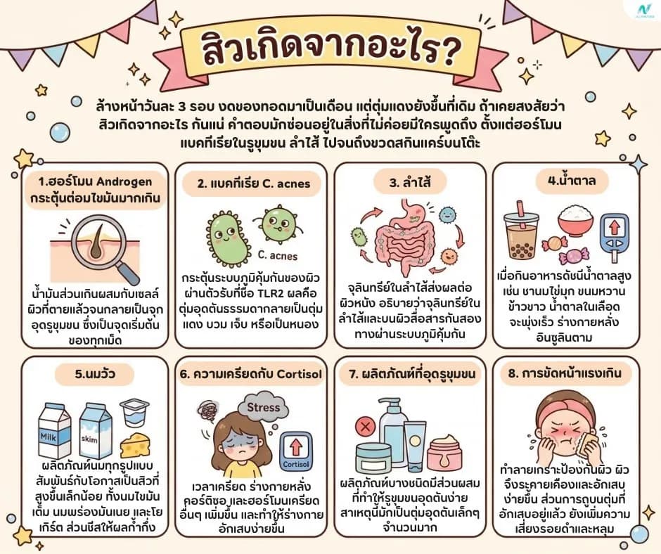 ภาพประกอบบทความ: สิวเกิดจากอะไร? 8 สาเหตุที่คนมักมองข้าม