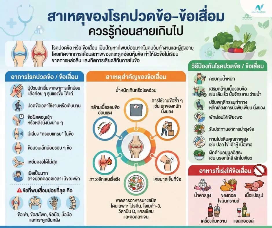 ภาพประกอบ: โรคปวดข้อ–ข้อเสื่อม: สาเหตุ การป้องกัน และอาหารบำรุงข้อให้แข็งแรง