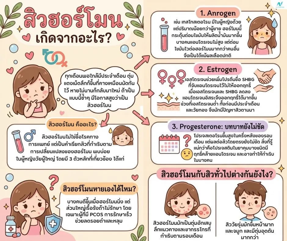 บทความสุขภาพ: สิวฮอร์โมน เกิดจากอะไร? แก้ยังไงให้หาย