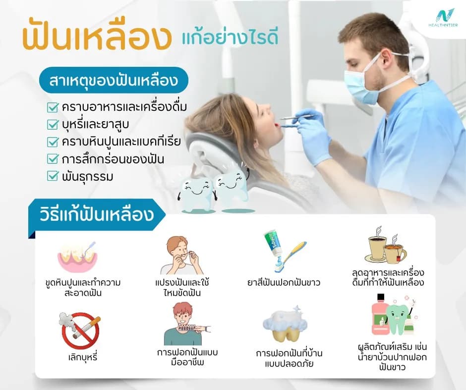 ภาพประกอบด้านสุขภาพ: แก้ฟันเหลืองอย่างไรดี? วิธีฟอกฟันขาว ปลอดภัยและได้ผล