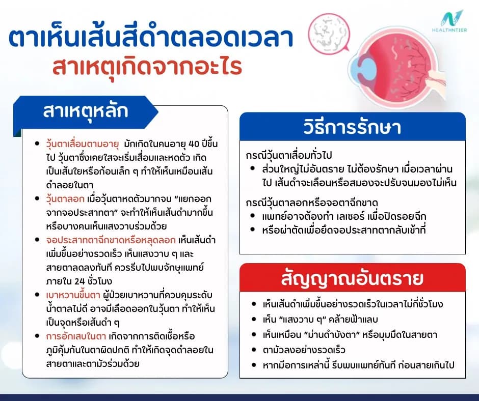 ภาพประกอบด้านสุขภาพ: ตาเห็นเส้นสีดำตลอดเวลา คืออะไร สาเหตุ อันตราย และวิธีดูแลรักษา