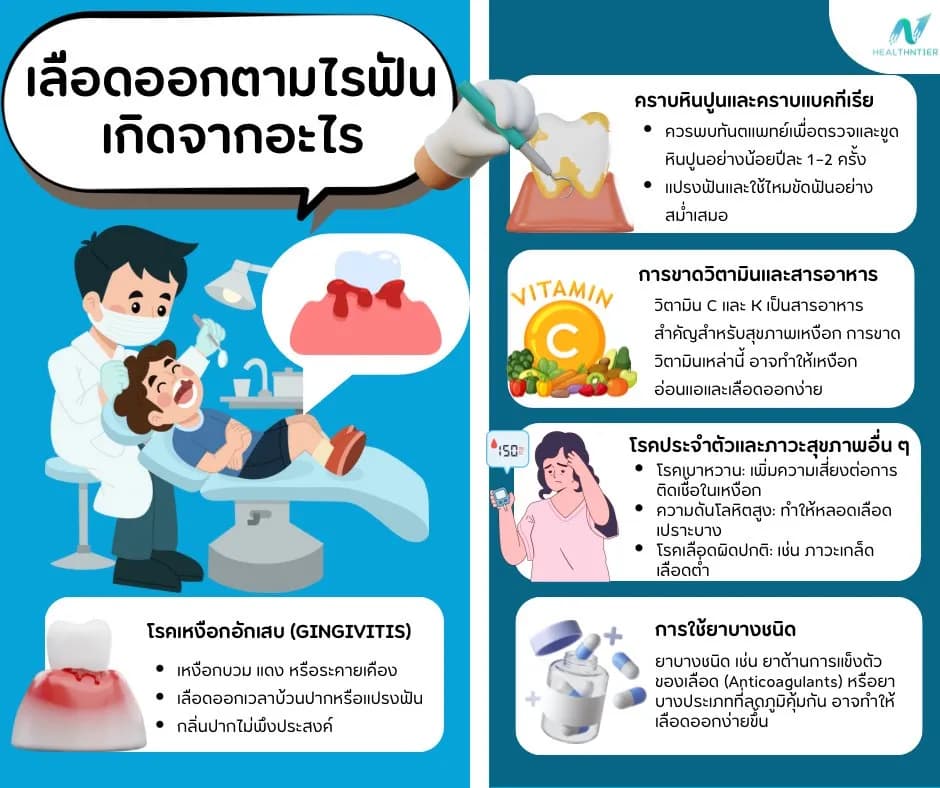 ภาพประกอบด้านสุขภาพ: เลือดออกตามไรฟัน เกิดจากอะไร? วิธีป้องกันและดูแลเหงือกให้แข็งแรง