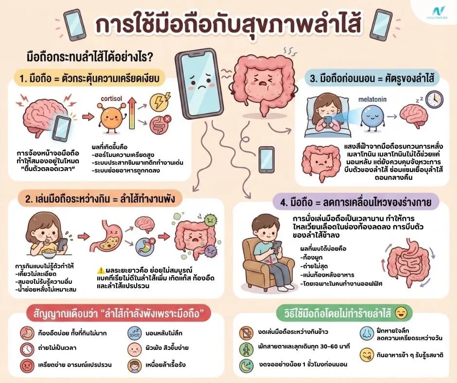 ภาพประกอบด้านสุขภาพ: การใช้มือถือกับสุขภาพลำไส้: เล่นทุกวัน แต่รู้ไหมกำลังทำลำไส้พัง