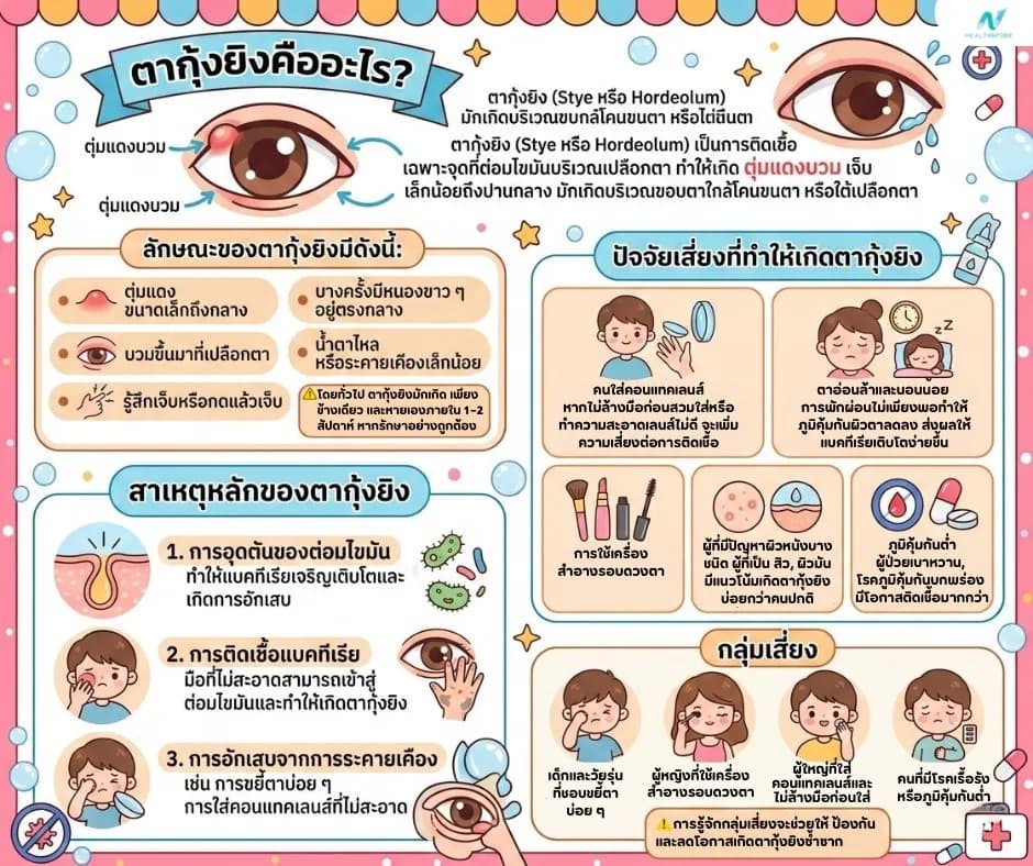 ภาพประกอบด้านสุขภาพ: ตากุ้งยิง คืออะไร? สาเหตุ อาการ วิธีรักษา