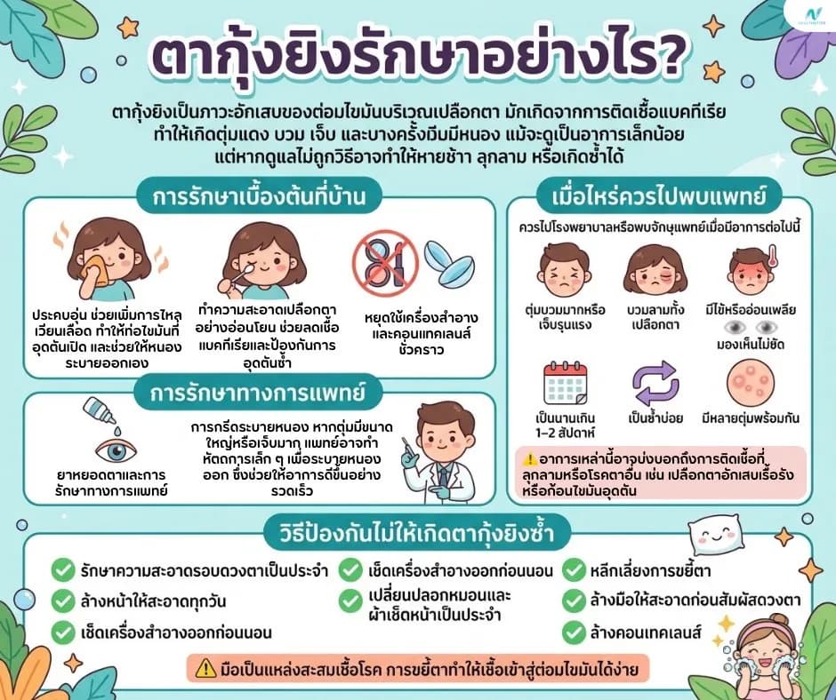 ภาพประกอบ: ตากุ้งยิงรักษายังไง? วิธีดูแลที่บ้านและเมื่อไหร่พบแพทย์