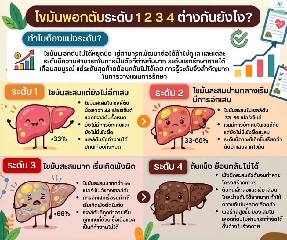 ภาพประกอบ: ไขมันพอกตับระดับ 1 2 3 4 ต่างกันยังไง? อันตรายแค่ไหน