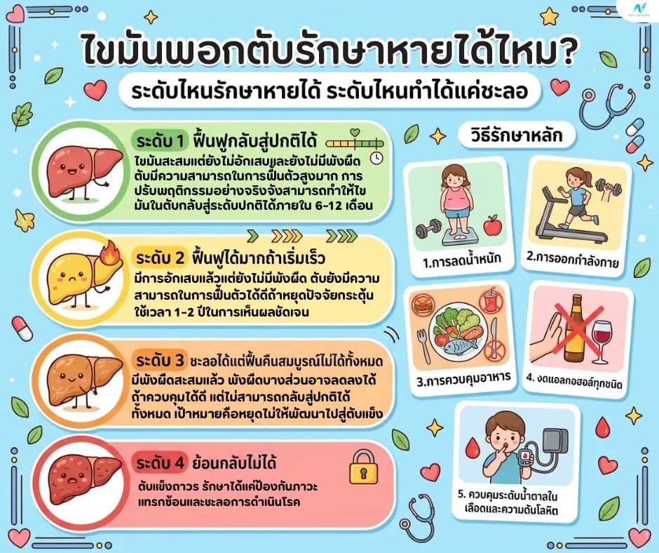 ภาพประกอบ: ไขมันพอกตับรักษาหายได้ไหม? วิธีรักษาและระยะเวลาที่ใช้